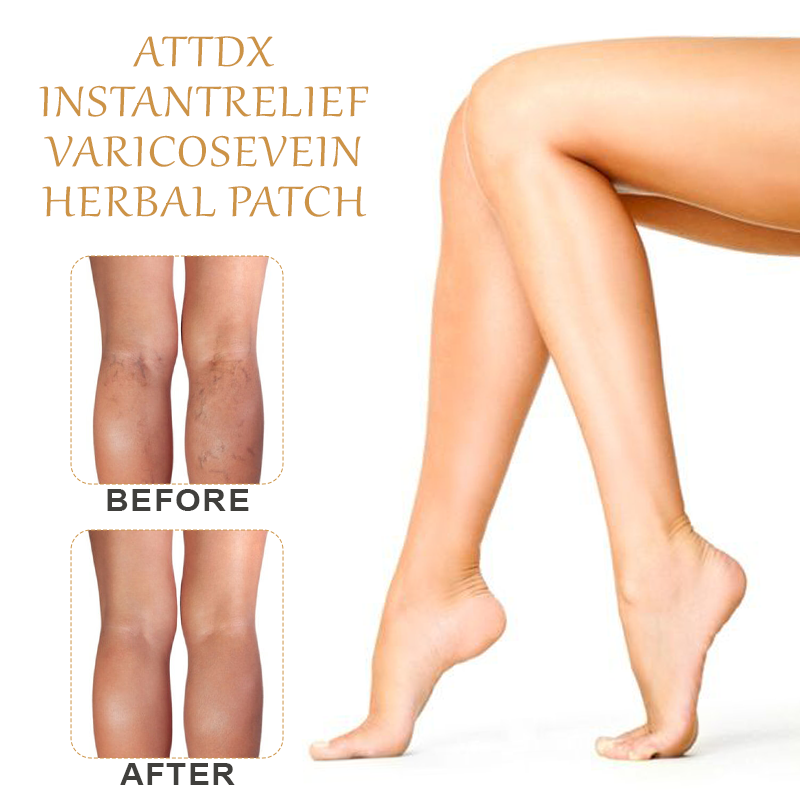 ATTDX InstantRelief VaricoseVein Herbal Patch