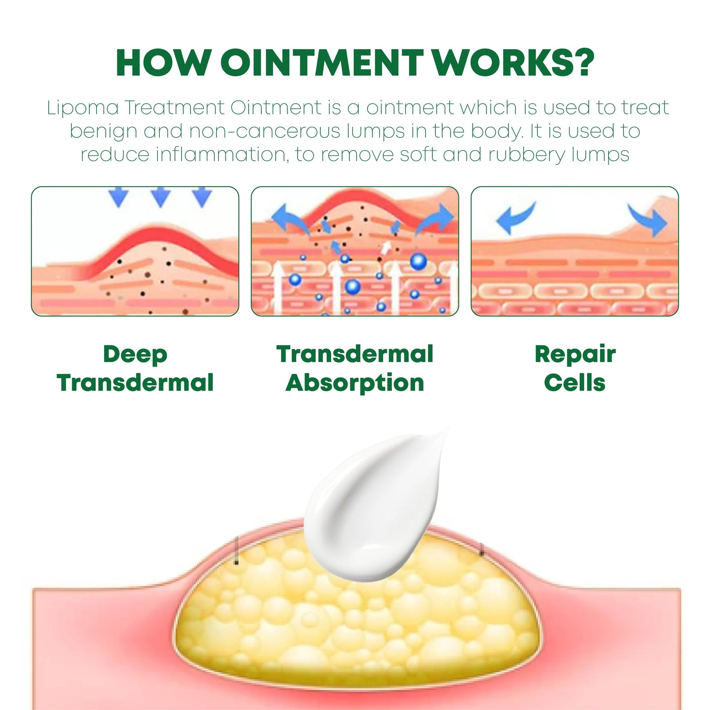 ATTDX LipomaRemoval Herbal Cream