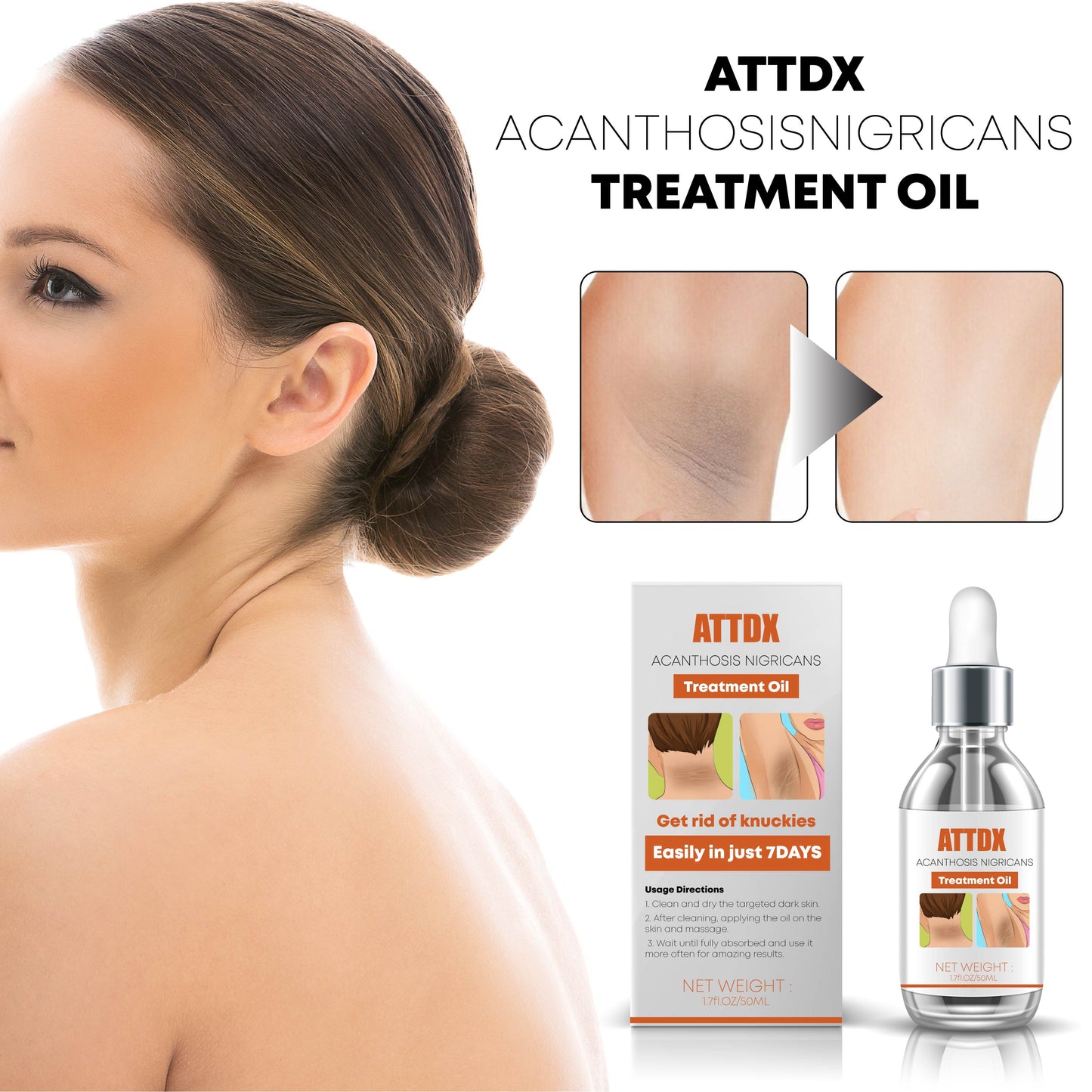 ATTDX AcanthosisNigricans Treatment Oil