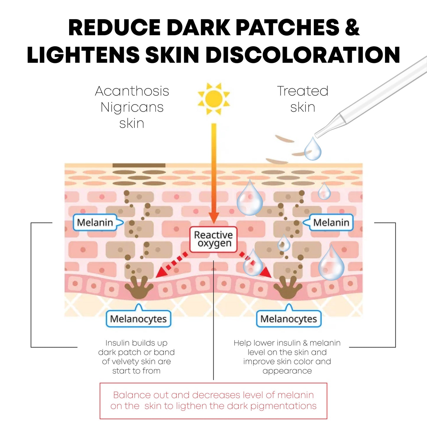 ATTDX AcanthosisNigricans Treatment Oil