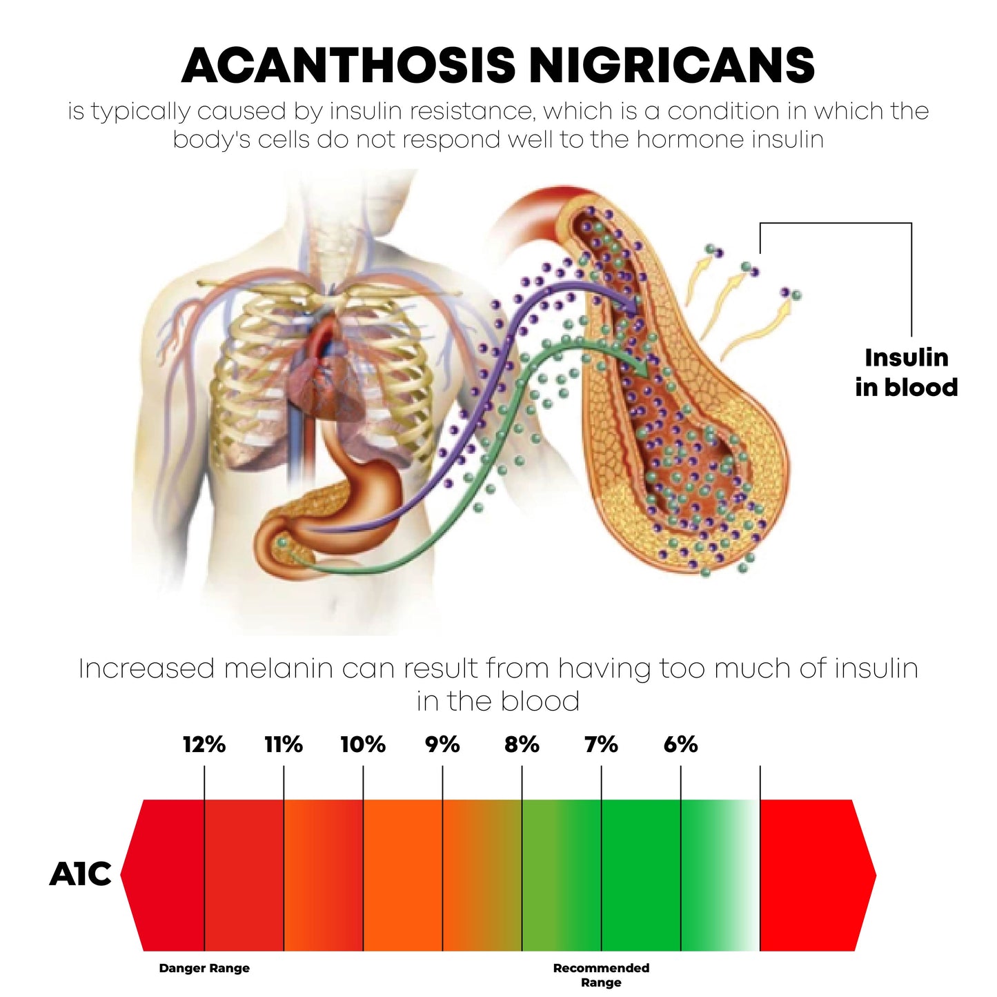 ATTDX AcanthosisNigricans Treatment Oil