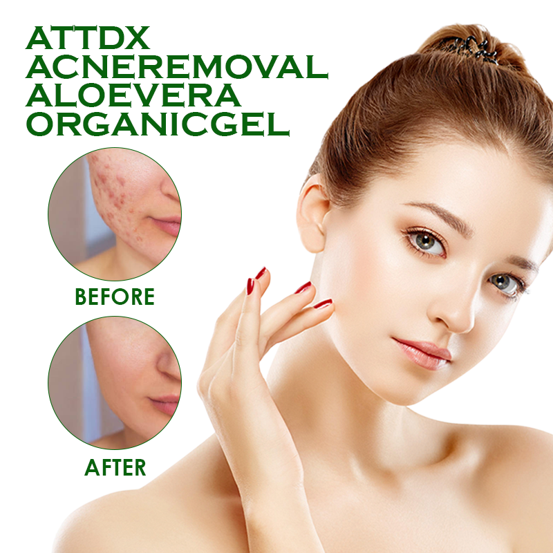 ATTDX AcneRemoval AloeVera OrganicGel