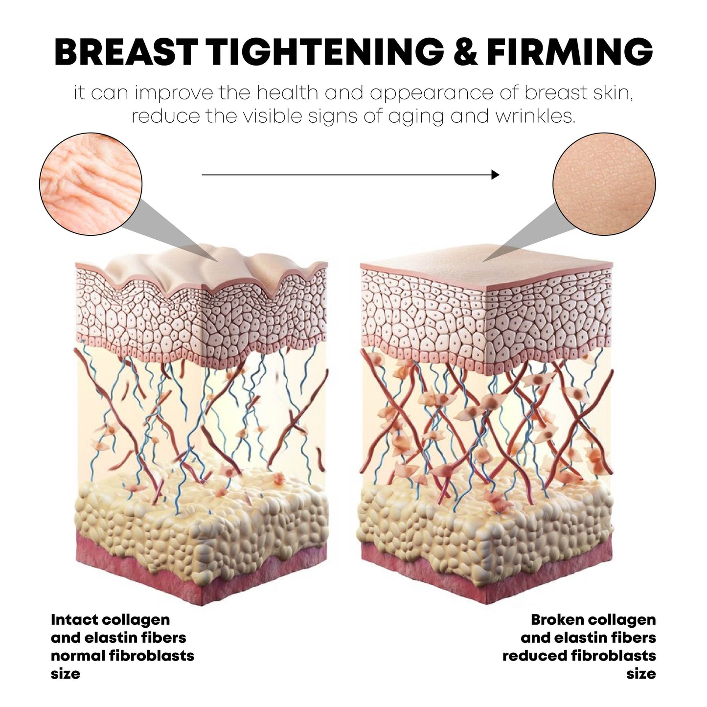 ATTDX Acupoint BreastEnhance LiftingPatch