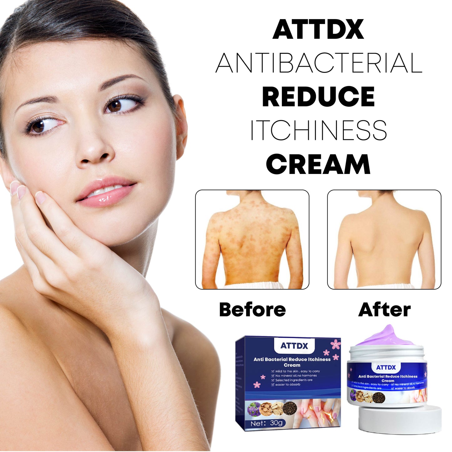 ATTDX AntiBacterial Reduce Itchiness Cream