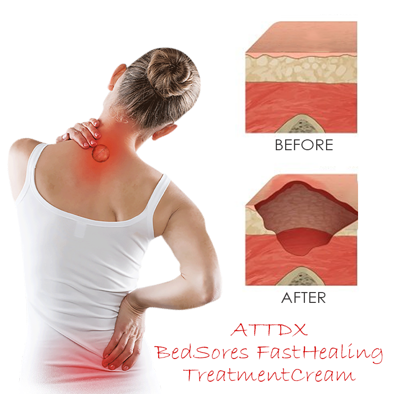 ATTDX BedSores FastHealing TreatmentCream