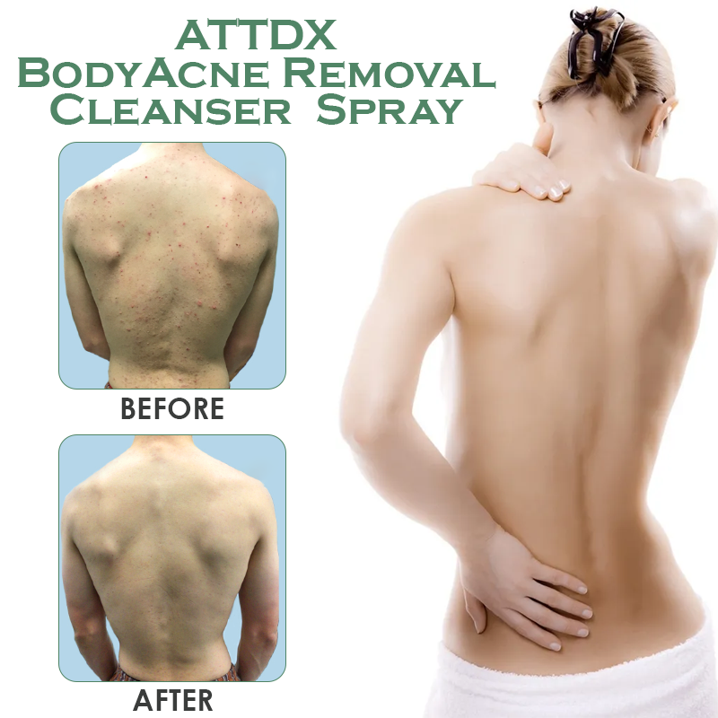 ATTDX BodyAcne Removal Cleanser  Spray