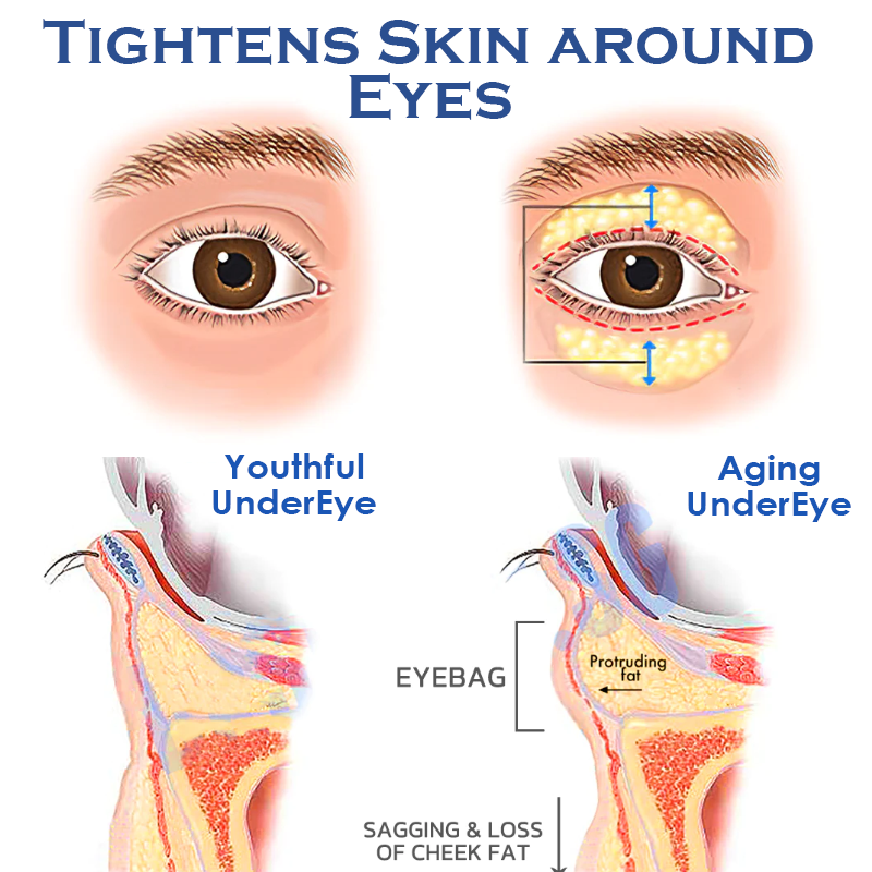 ATTDX Caffeine EyeDepuffing LiftingGel