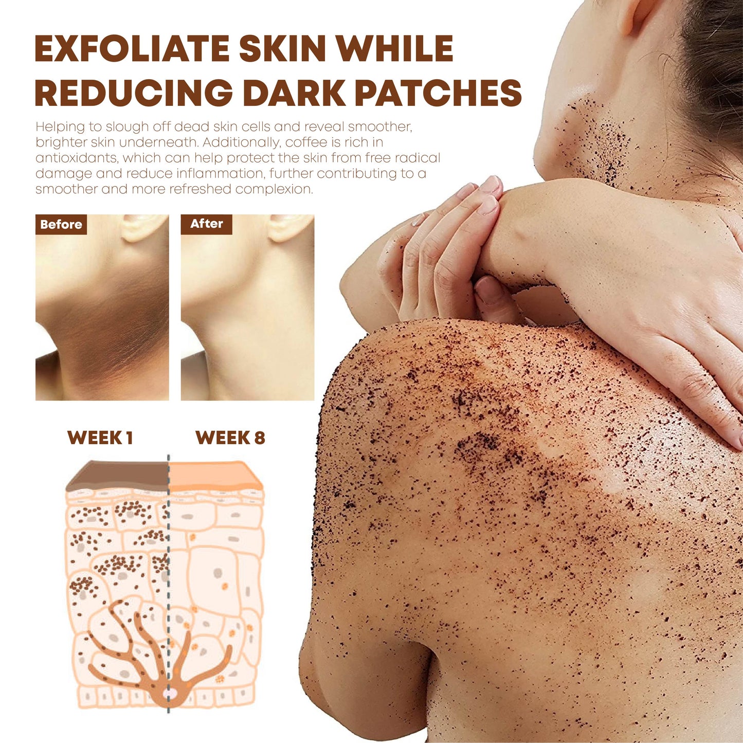 ATTDX Coffee Acanthosis Nigricans BodyScrub