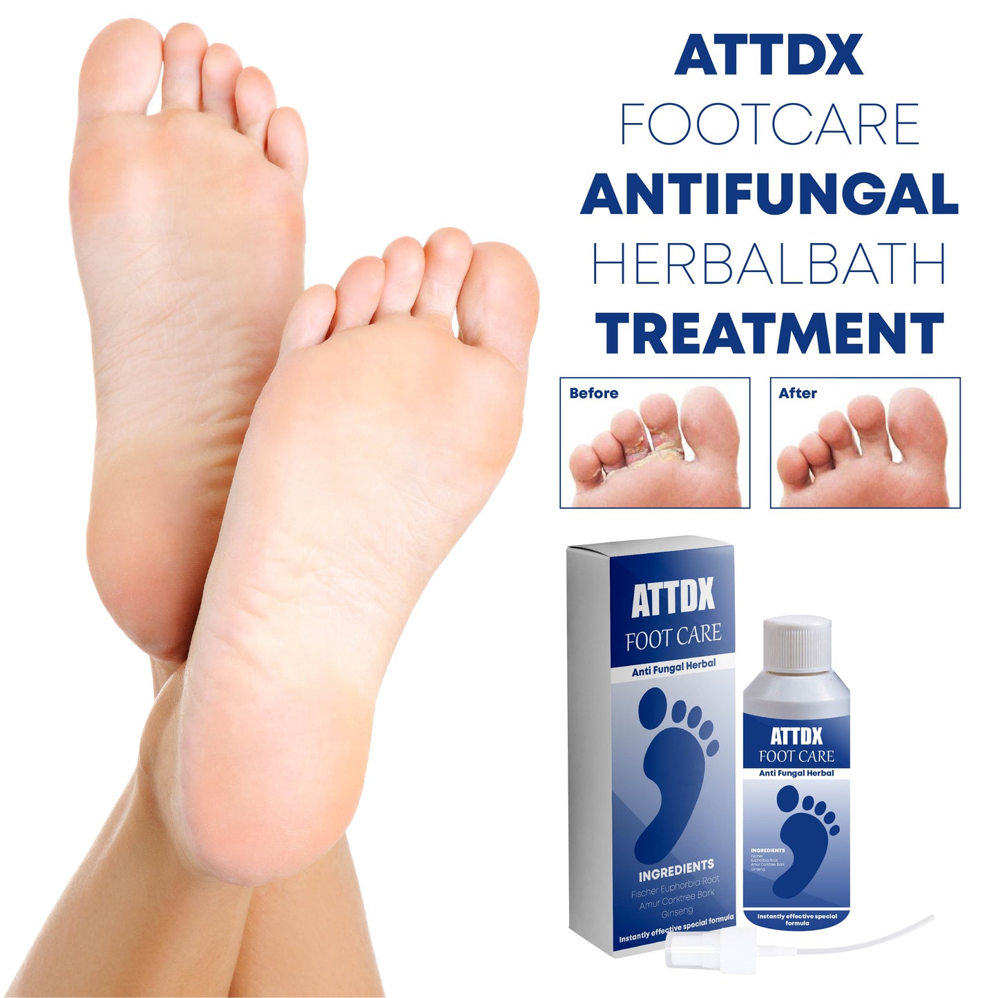 ATTDX FootCare AntiFungal HerbalBath Treatment