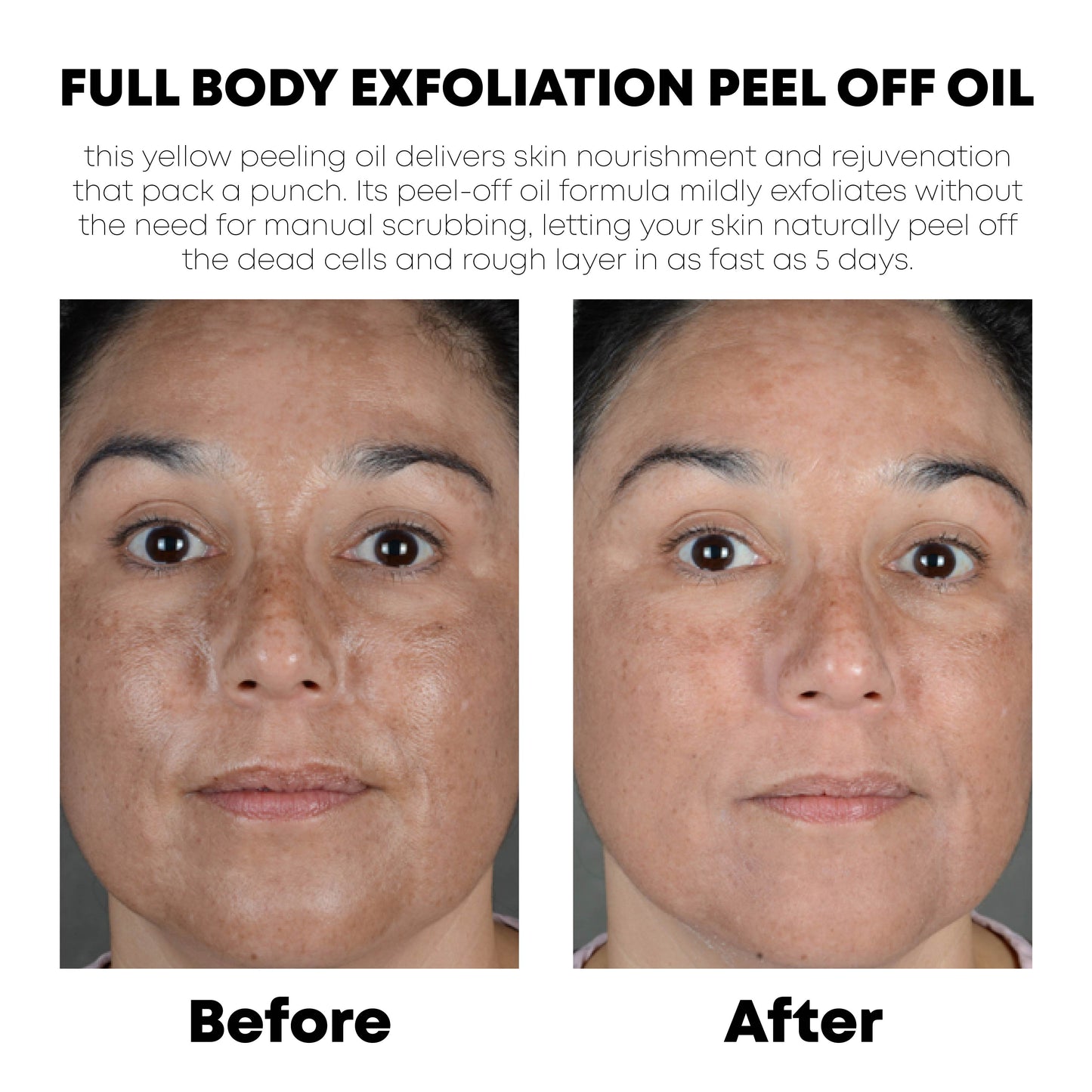 ATTDX FullBody Exfoliation PeelingOil