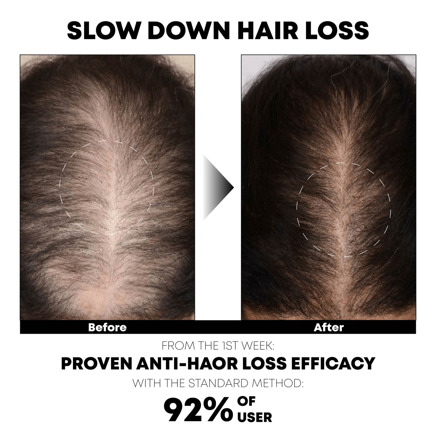 ATTDX HairRegrowth Rice Essence ShampooBar