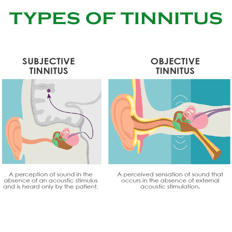 ATTDX Instant TinnitusReduce Relief Nasal Inhaler