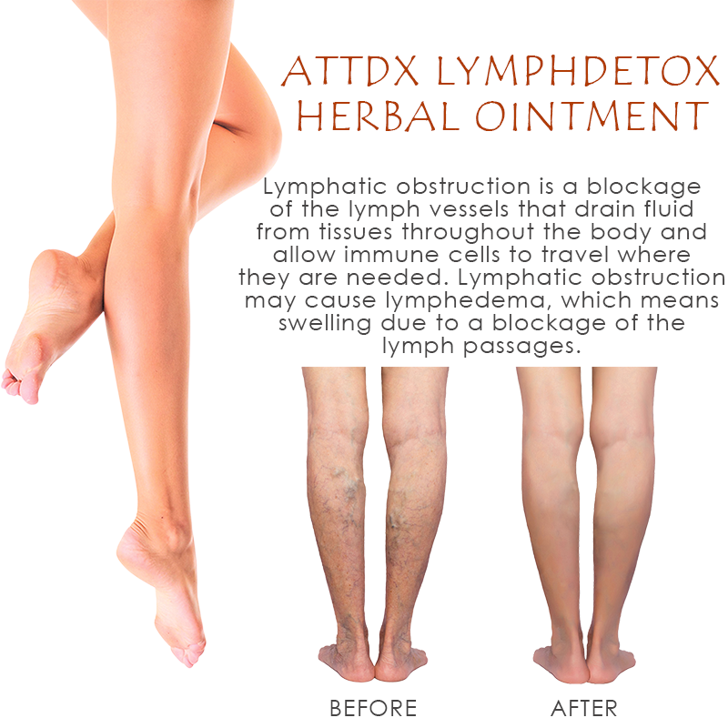 ATTDX LymphDetox Herbal Ointment