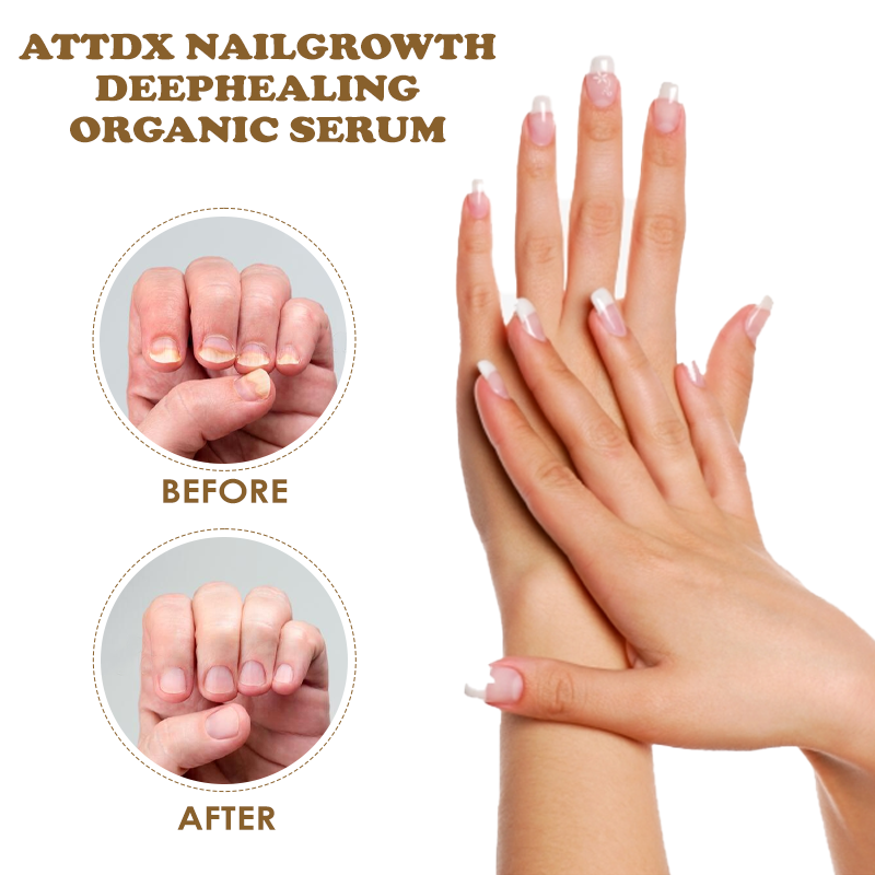 ATTDX NailGrowth DeepHealing Organic Serum