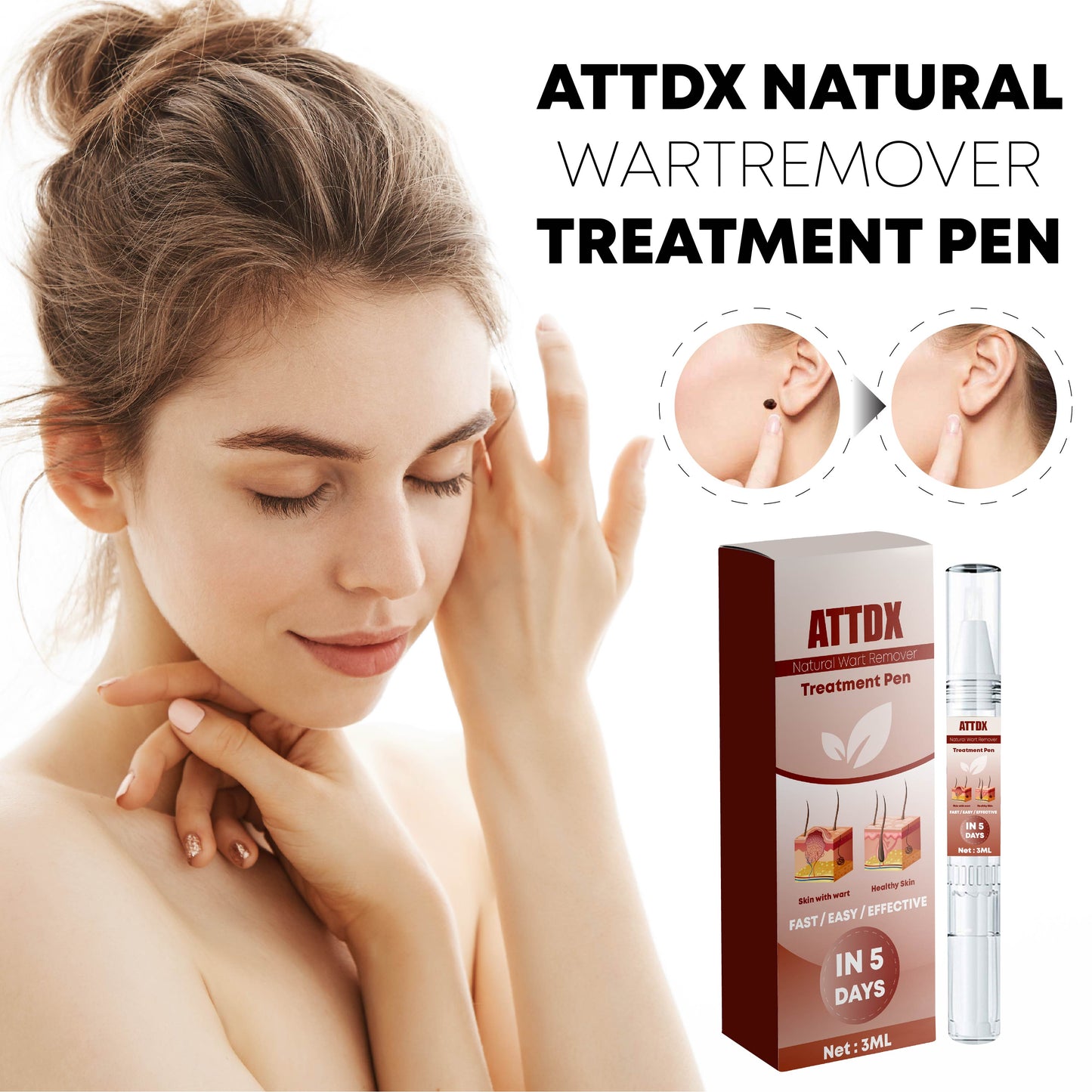 ATTDX Natural WartRemover Treatment Pen