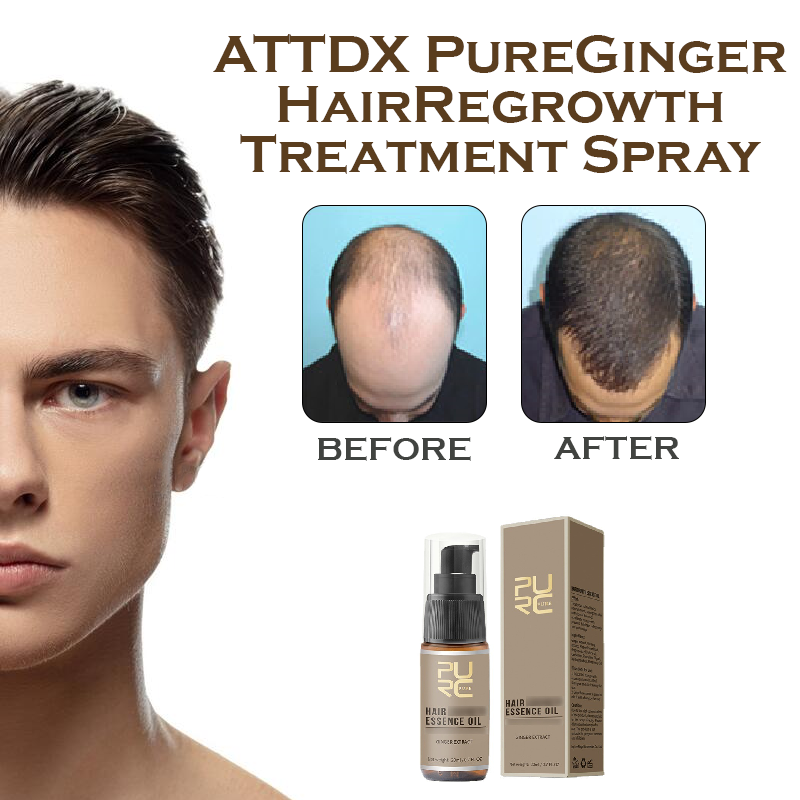 ATTDX PureGinger HairRegrowth Treatment Spray