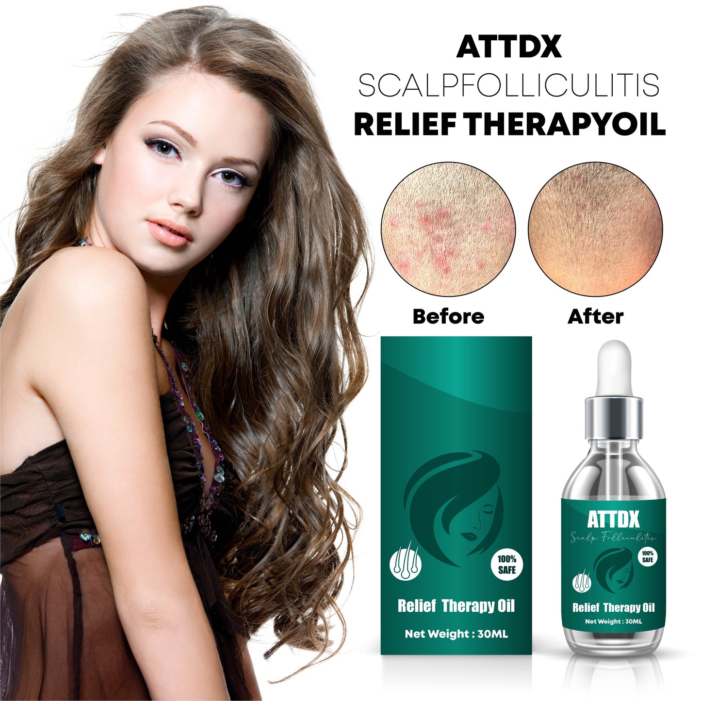 ATTDX ScalpFolliculitis Relief TherapyOil