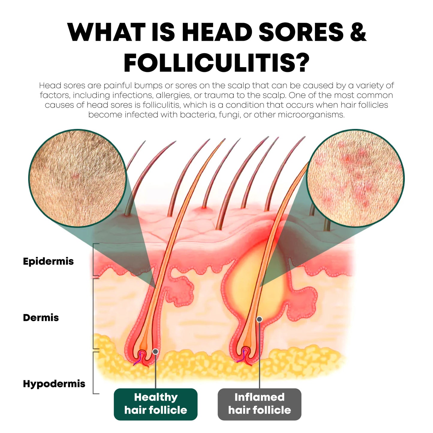 ATTDX ScalpFolliculitis Relief TherapyOil