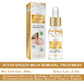 ATTDX Speedy Milia Removal Treatment