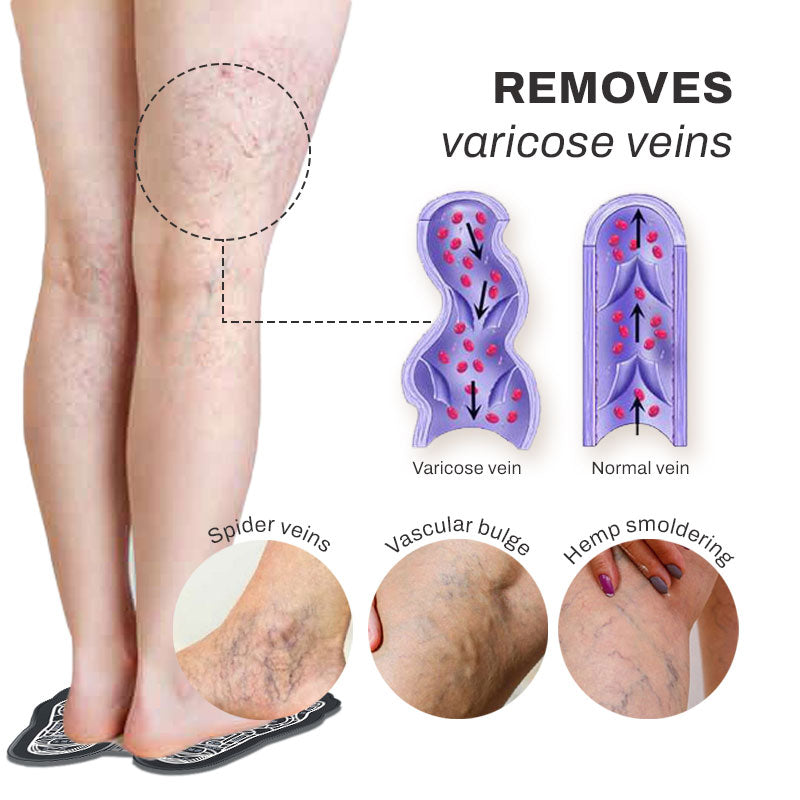 EMS Foot Massage Mat | get rid of swollen feet & varicose veins