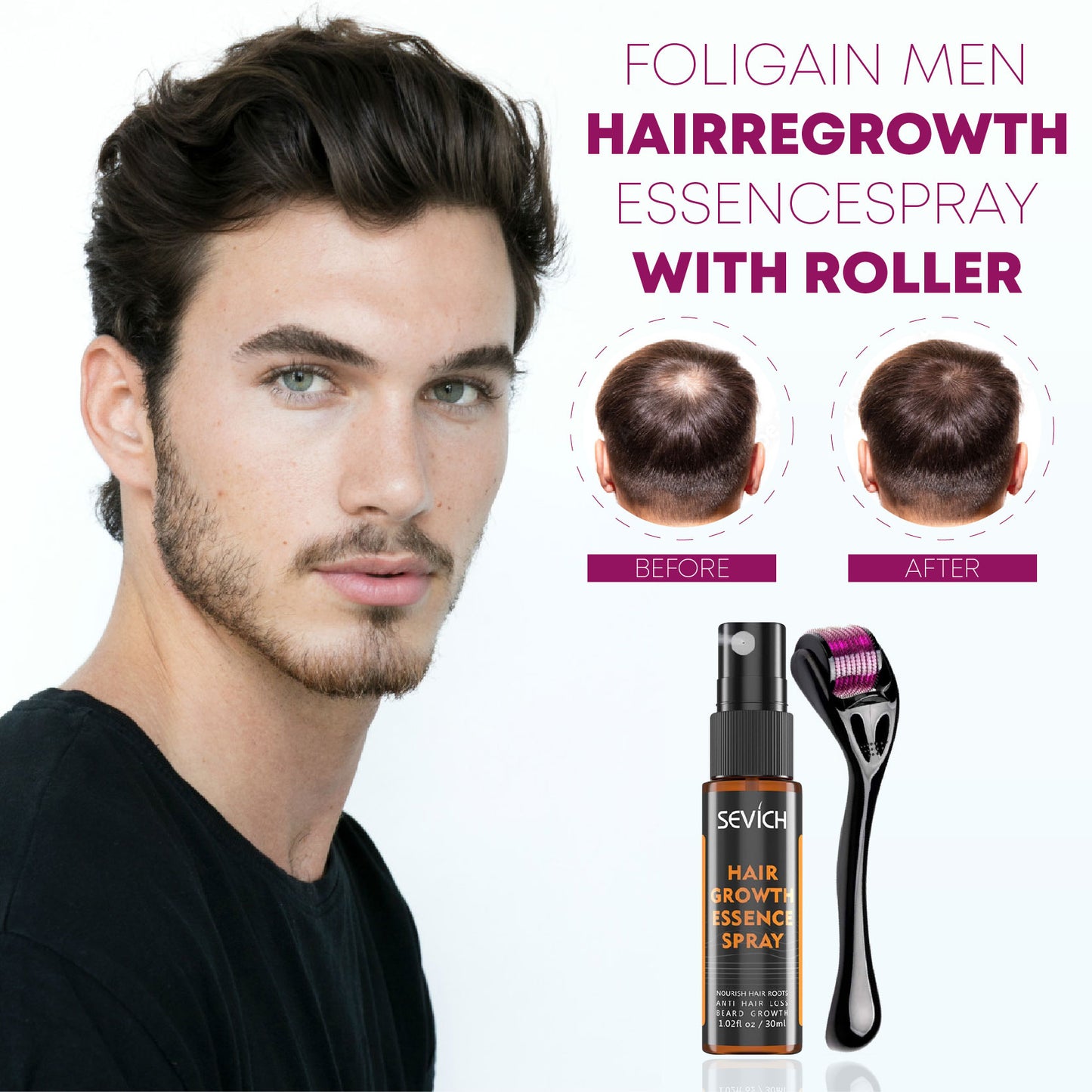 FOLIGAIN Men HairRegrowth EssenceSpray with Roller