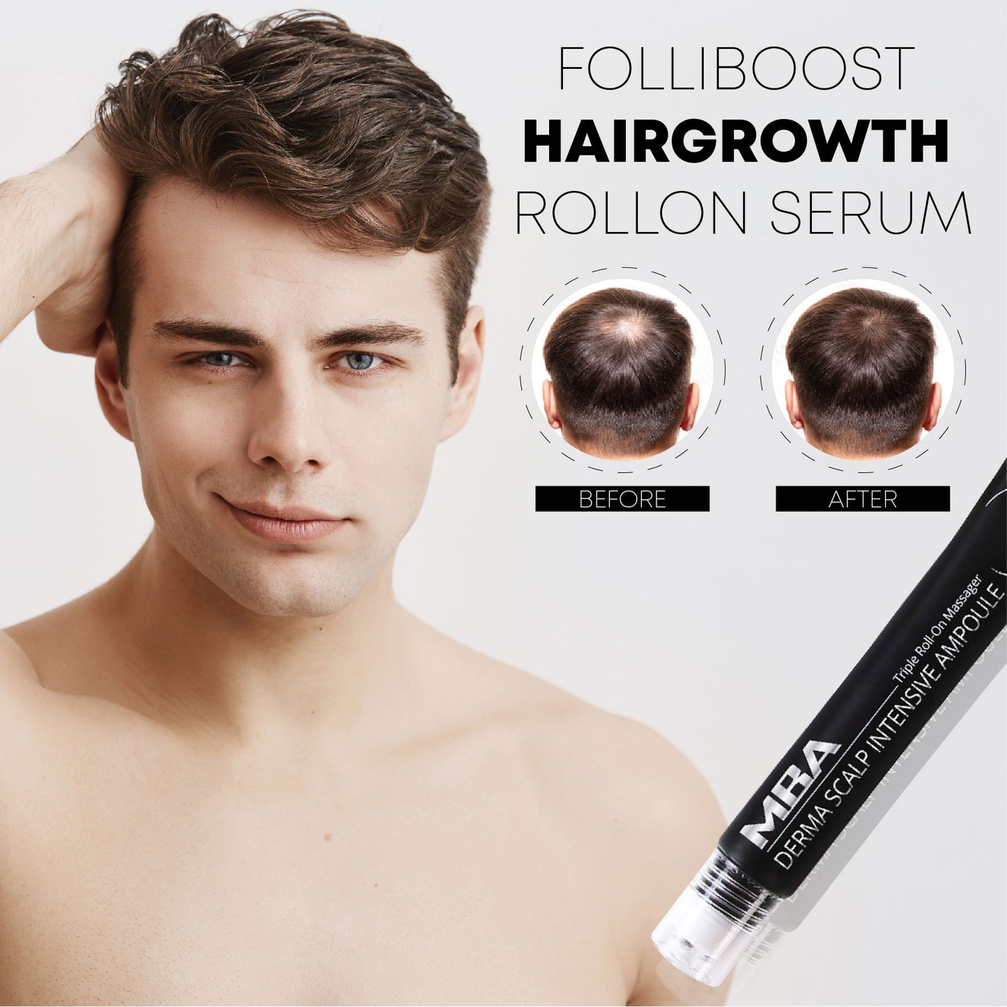 FolliBOOST HairGrowth RollOn Serum