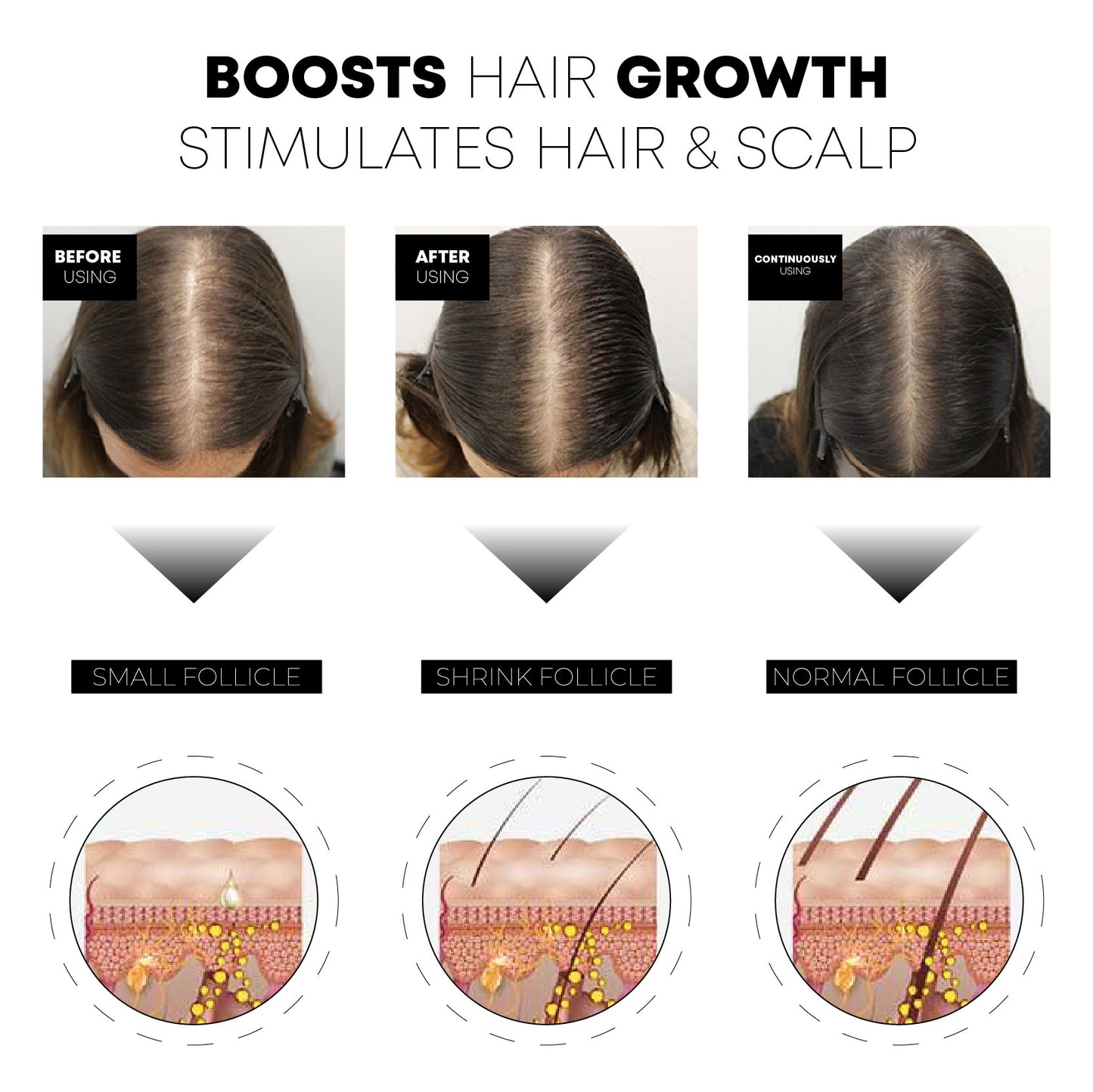 FolliBOOST HairGrowth RollOn Serum