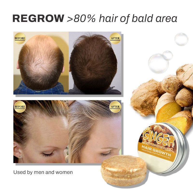 HairGrowth Herbal Ginger ShampooBar