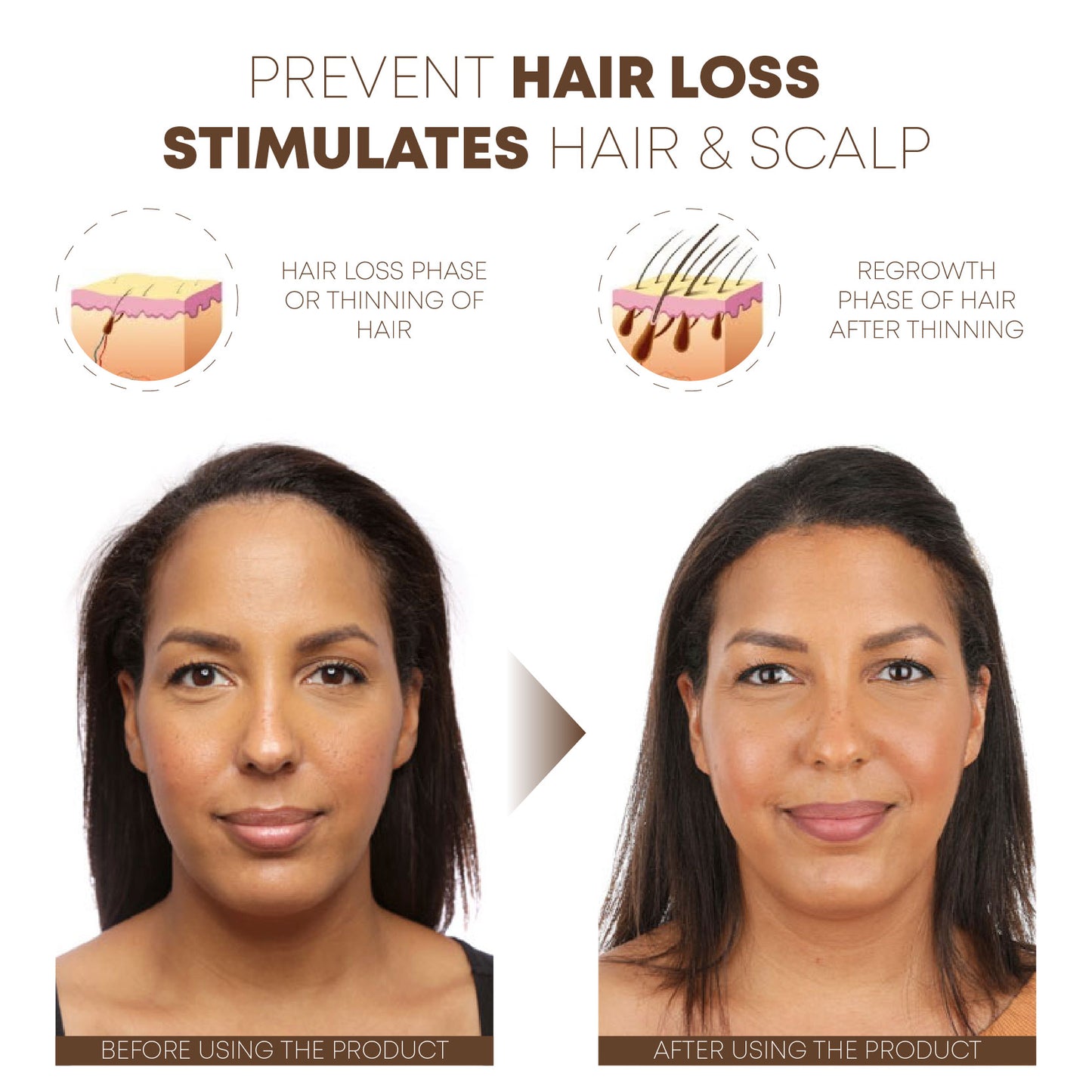 HairPlus AntiHairLoss Vitamin Capsules