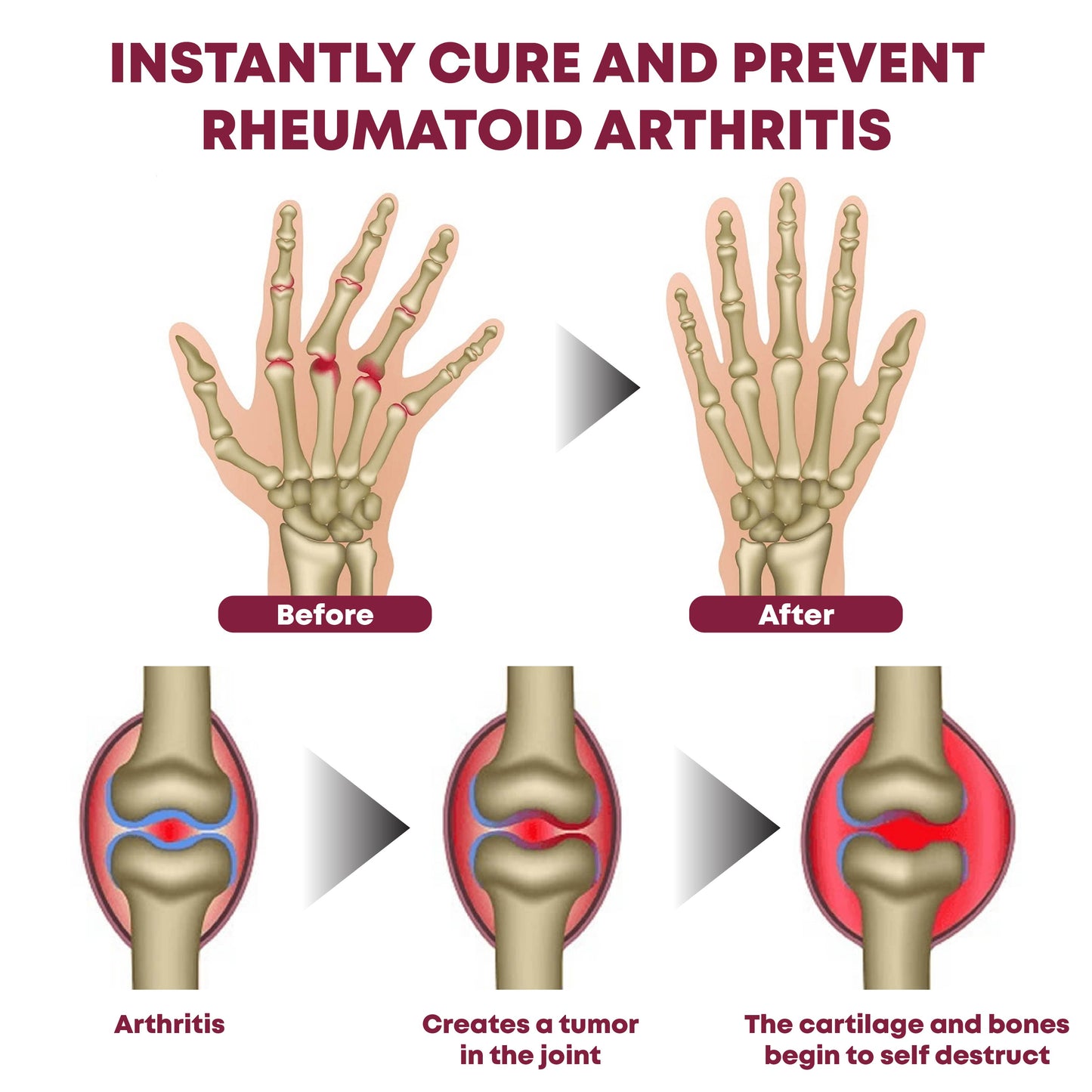 ATTDX ProRelief JointRecovery TherapyCream