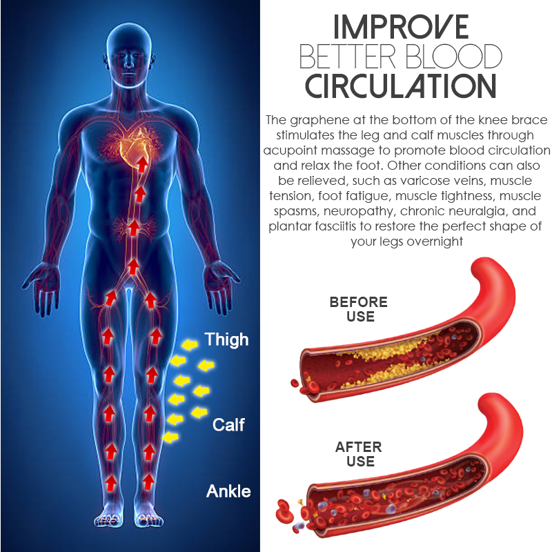 Ricpind ProTourmaline SelfHeating AcupressureKnee Sleeve