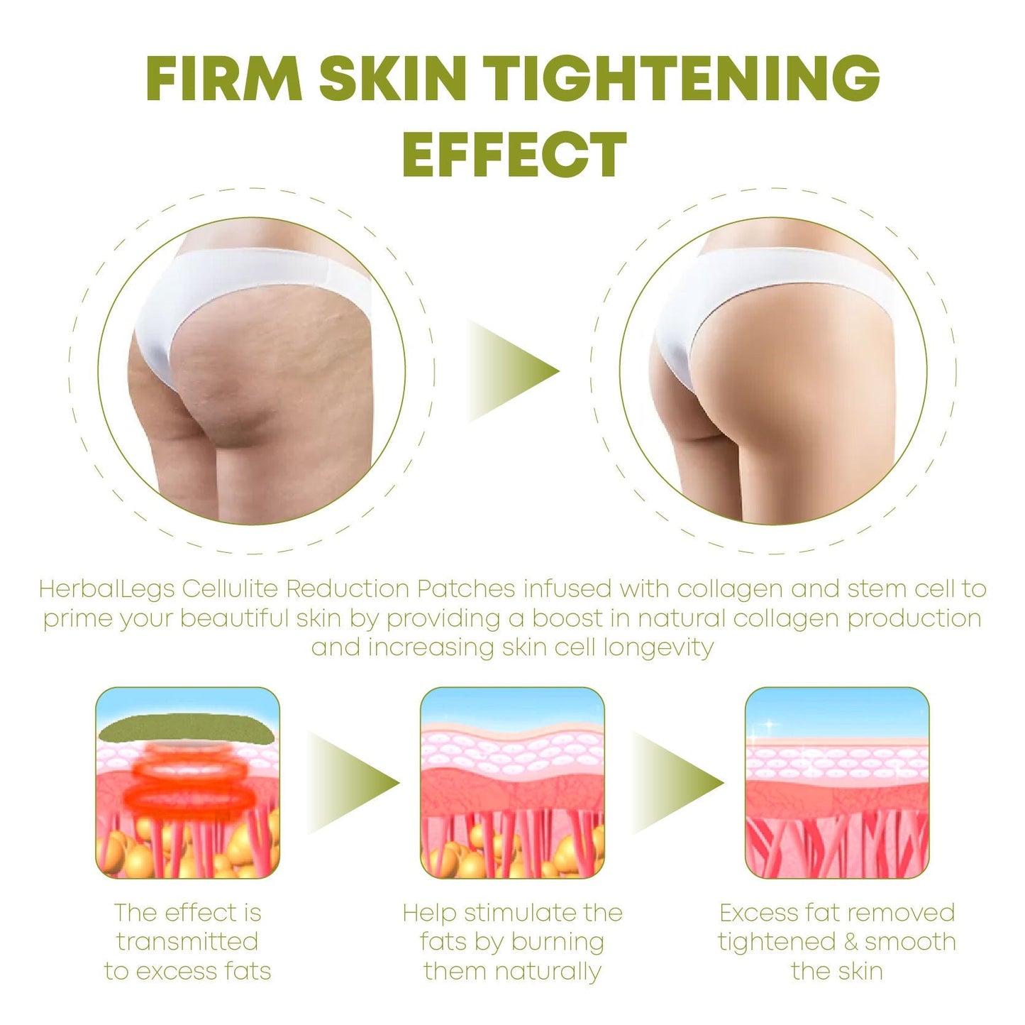 ProHerbal CelluliteReduction LegsFirming Patches