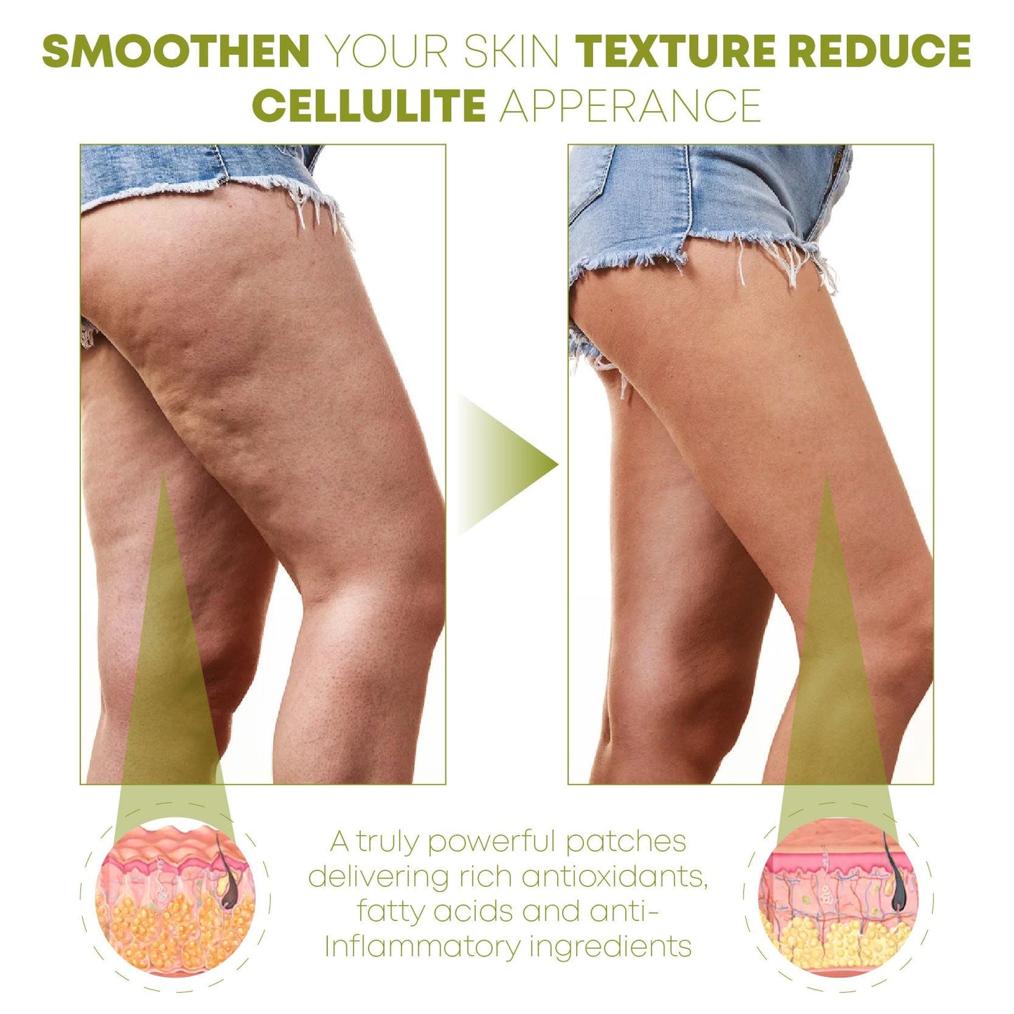 ProHerbal CelluliteReduction LegsFirming Patches