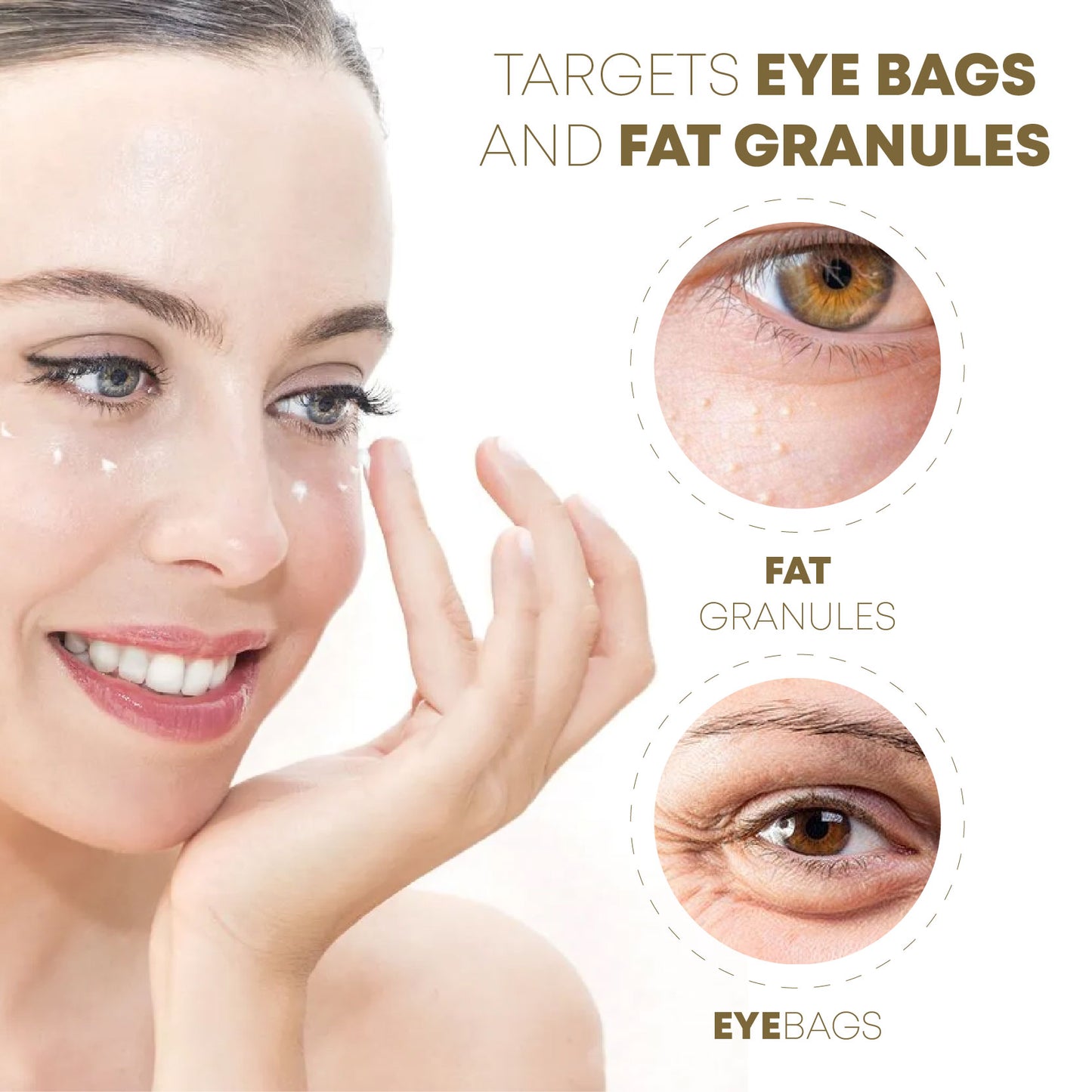 RapidFIX Eye FatGranules Removal HerbalCream