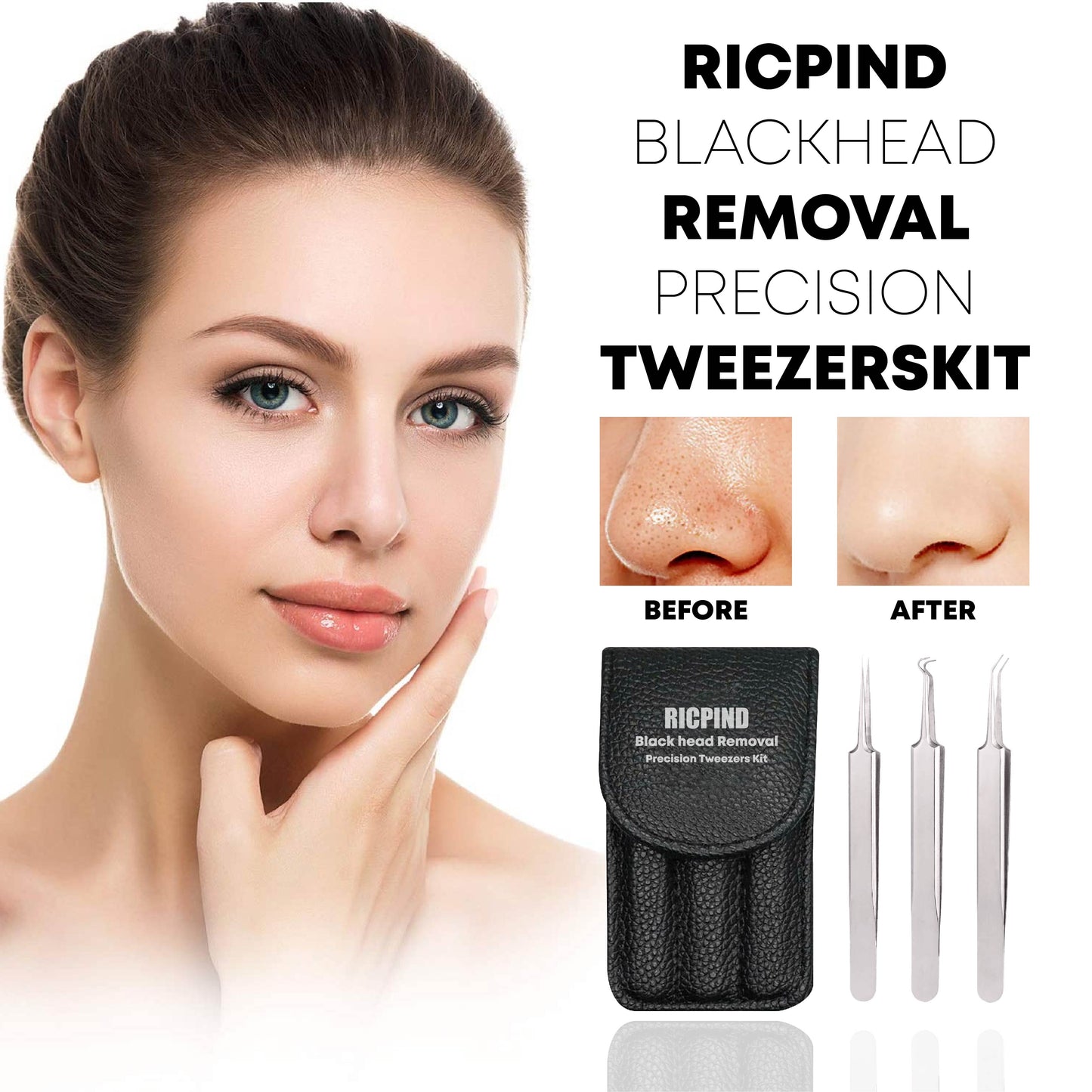 Ricpind BlackheadRemoval Precision TweezersKit