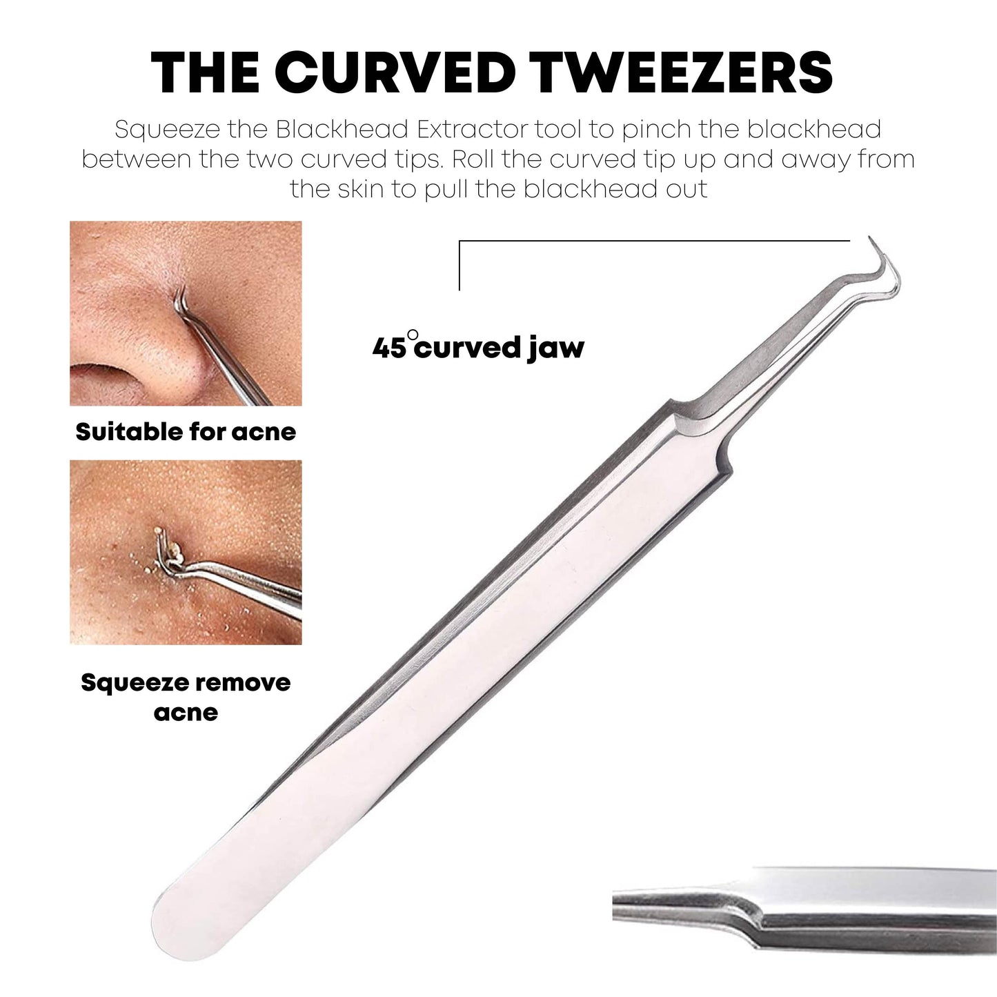 Ricpind BlackheadRemoval Precision TweezersKit