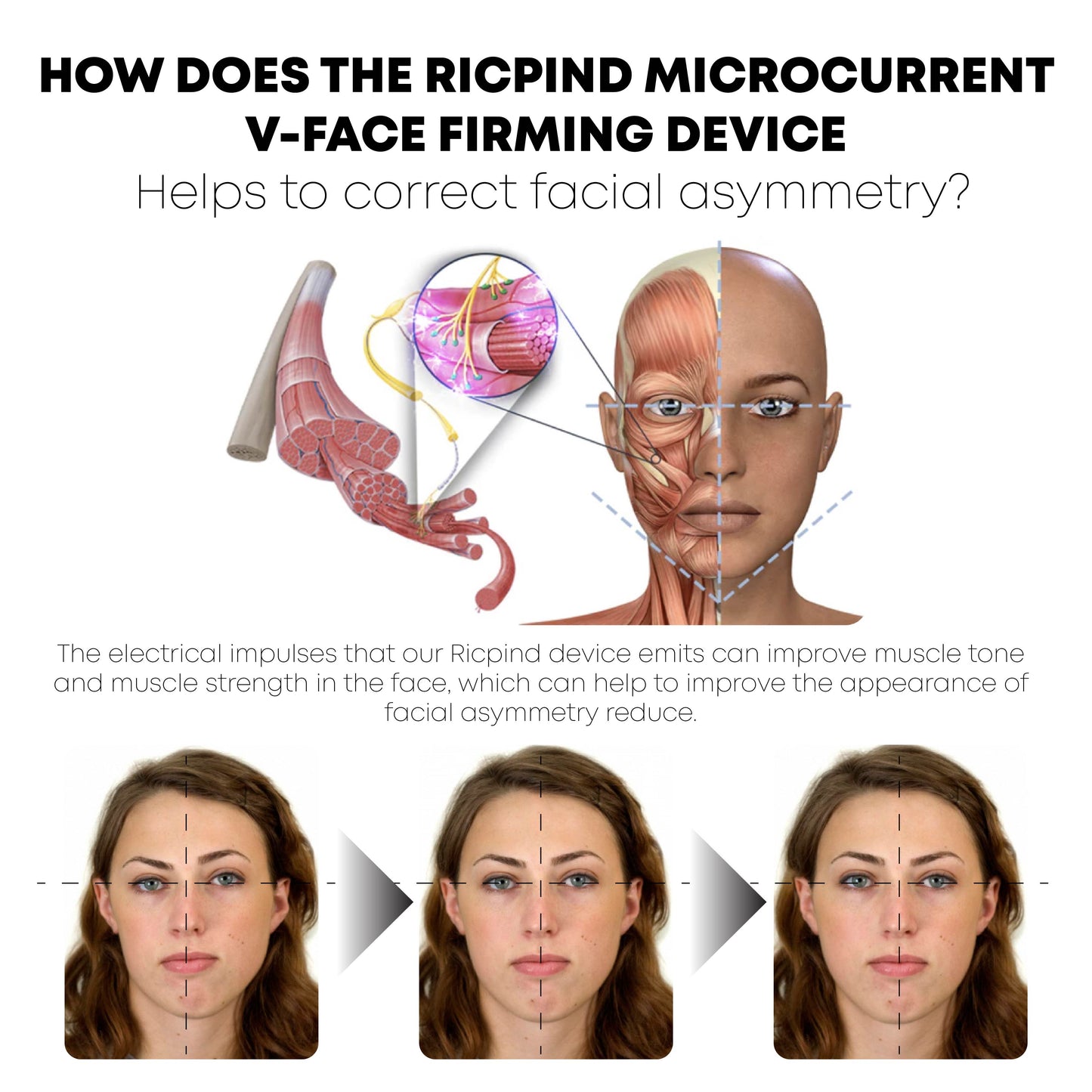 Ricpind Microcurrent VFace FirmingDevice