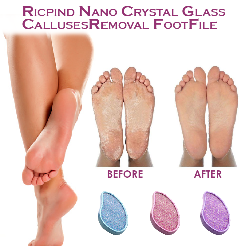 Ricpind Nano Crystal Glass CallusesRemoval FootFile