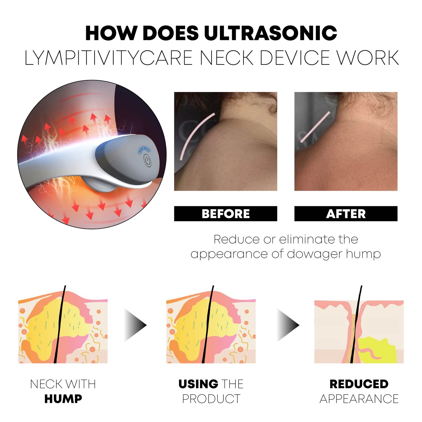 Ricpind Ultrasonic LympvityCare Neck Device