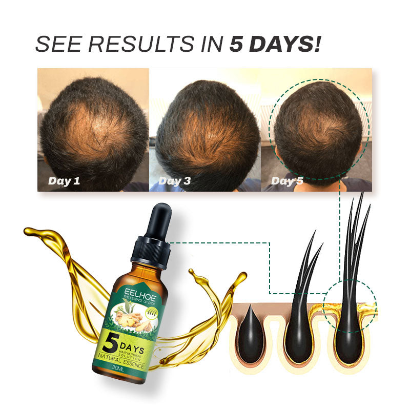 SaengGang Folliclvity HairGrowth Oil