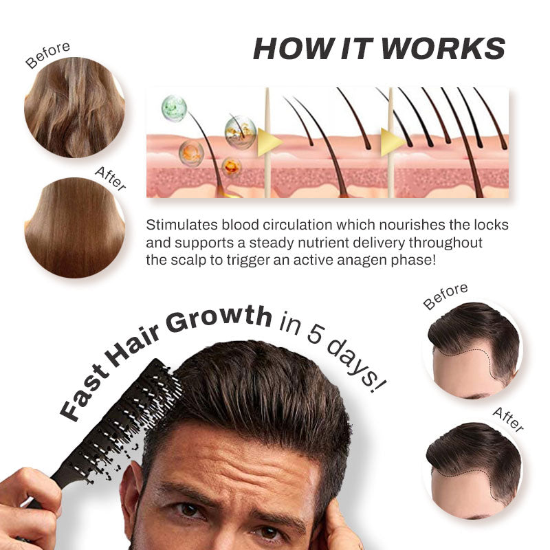 SaengGang Folliclvity HairGrowth Oil