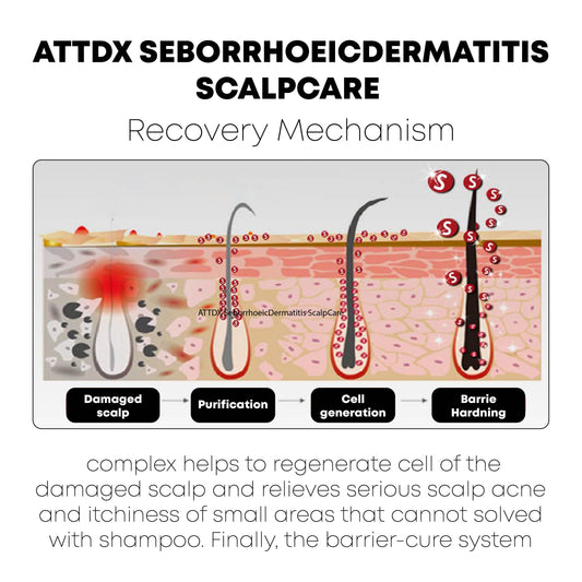 ATTDX SeborrhoeicDermatitis ScalpCare TreatmentCream