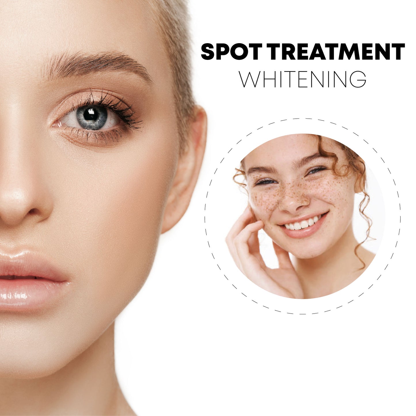 SkinSpot WhiteningFreckle Cream