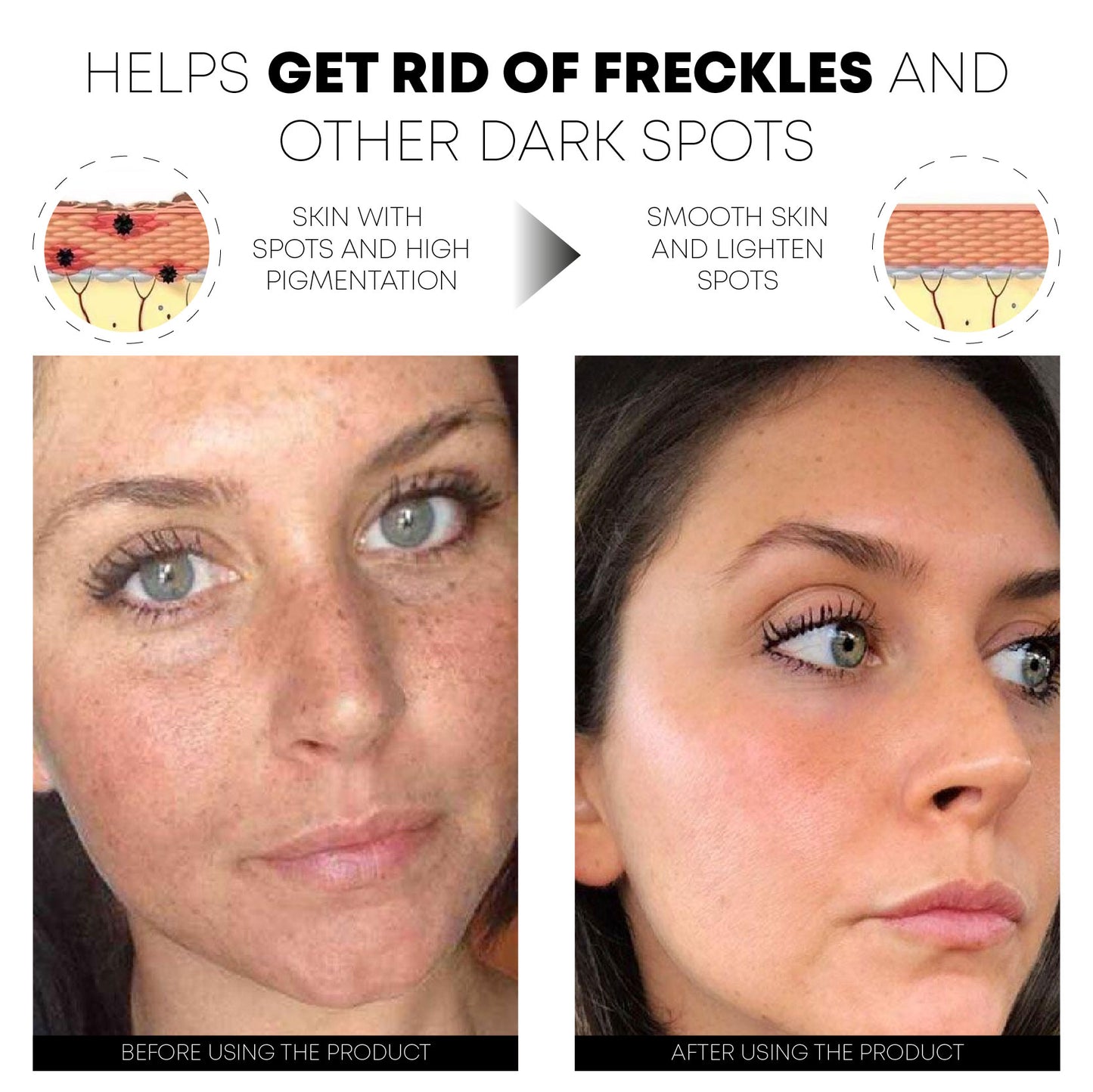 SkinSpot WhiteningFreckle Cream