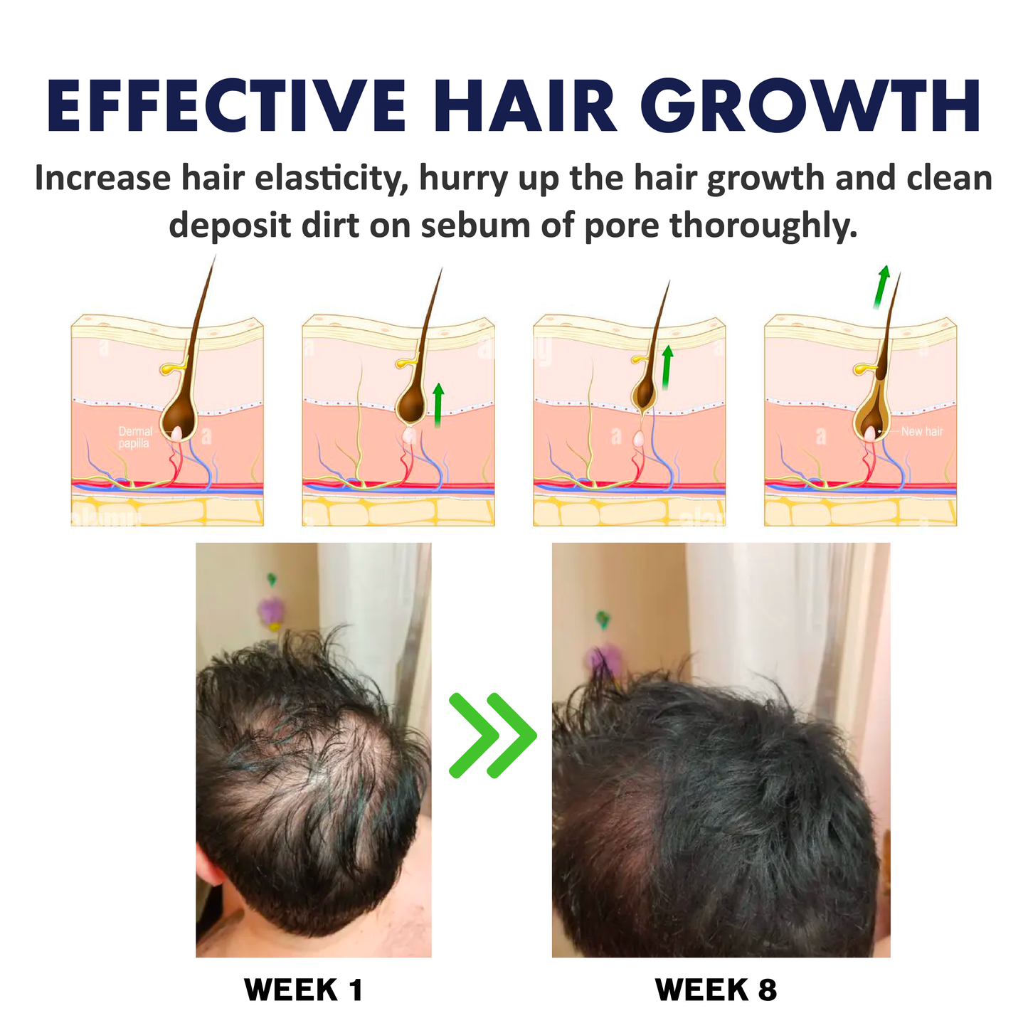 ATTDX HairRegrowth Exfoliate Scrub